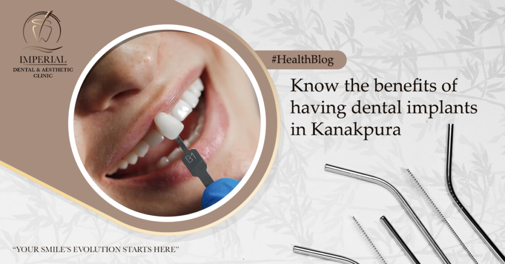 Know-the-benefits-of-having-dental-implants-in-Kanakpura