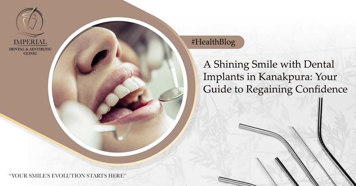 A-Shining-Smile-with-Dental-Implants-in-Kanakpura