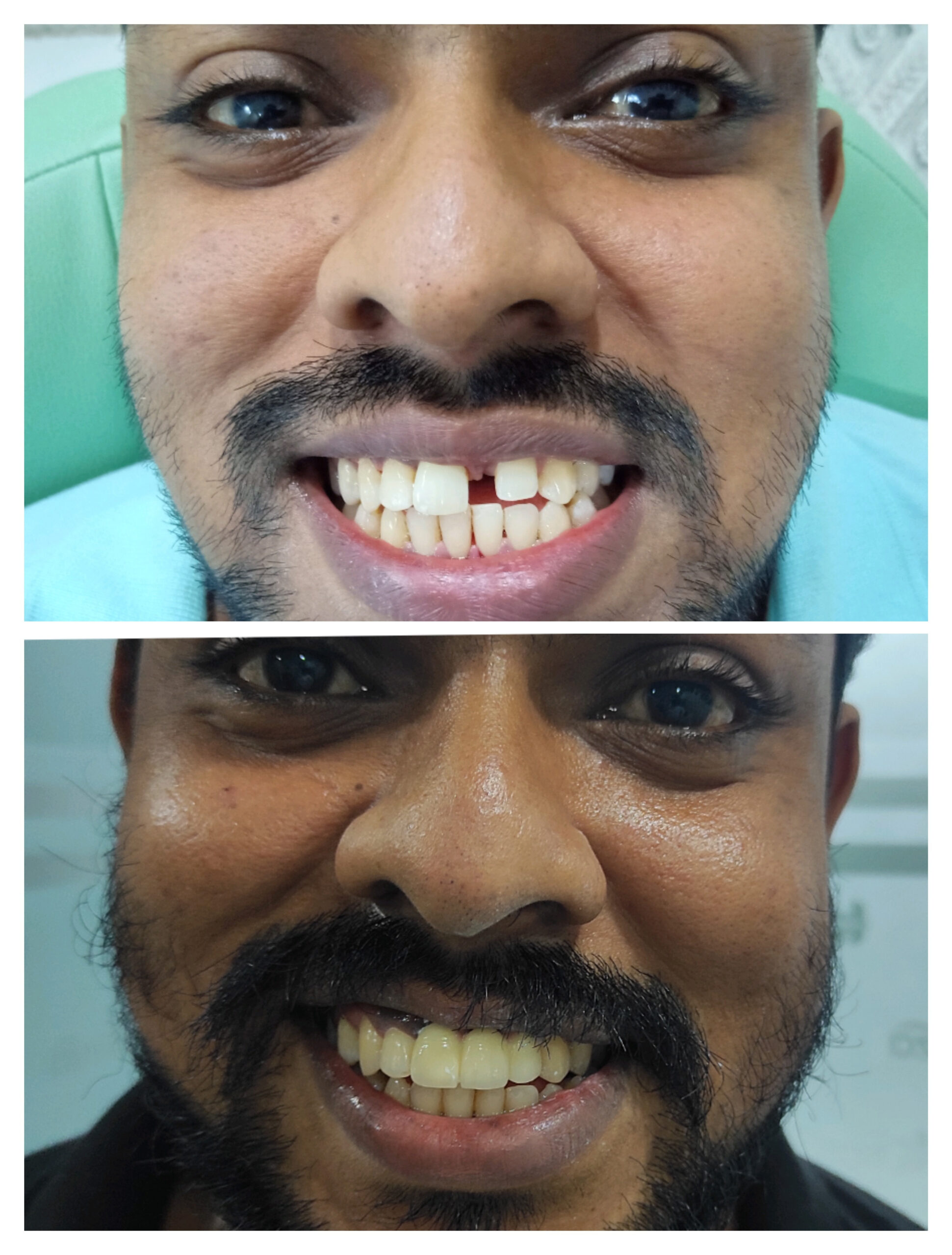 SMILE MAKEOVER